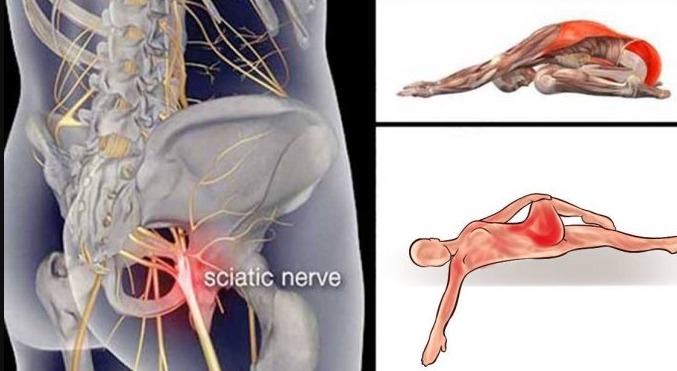 10 Piriformis Stretches to Get Rid of Sciatica, Hip, and Lower Back Pain