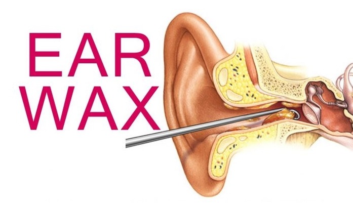 8 Natural Ways to Remove Your Earwax Buildup