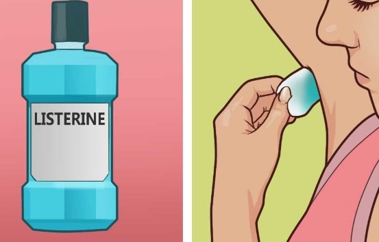 uses of Listerine mouthwash