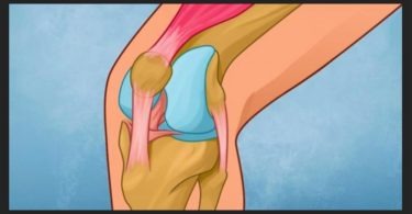 How to heel your knee and rebuild joint strength