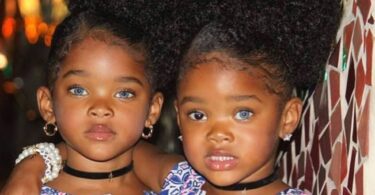 These blue-eyed black twins attracted thousands of internet users 8 years ago, here's what they look like today