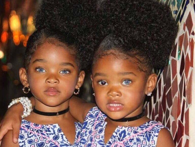 These blueeyed black twins attracted thousands of users 8