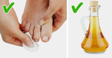 Apple Cider Vinegar Tip to Strengthen and Grow Nails1